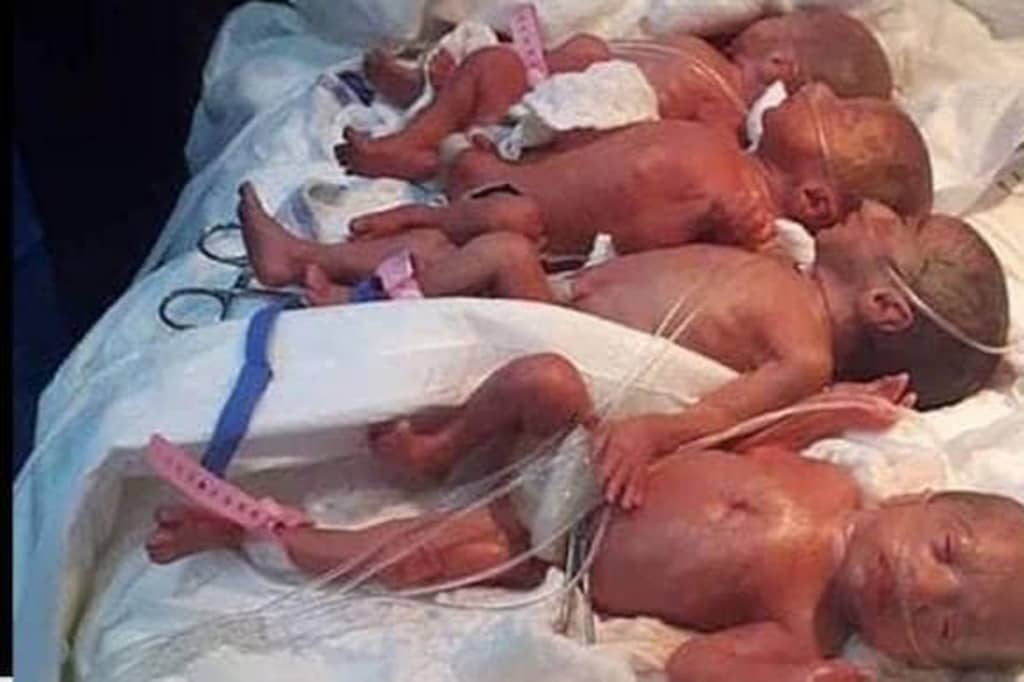 nonuplets-3-1