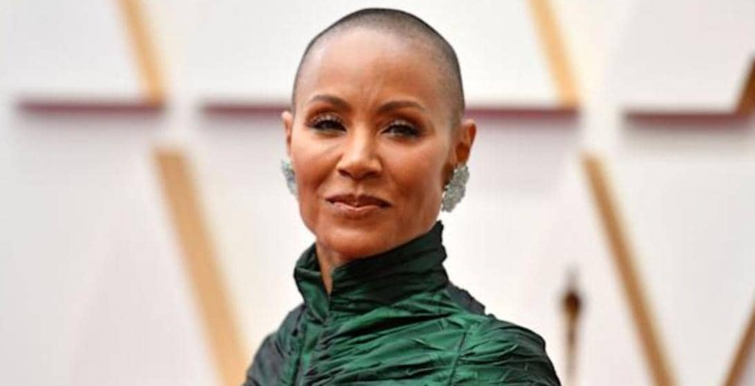 jada-pinkett-alopecia_62414680a78ab