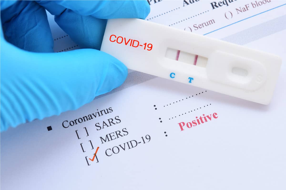 covid-19-test-positive