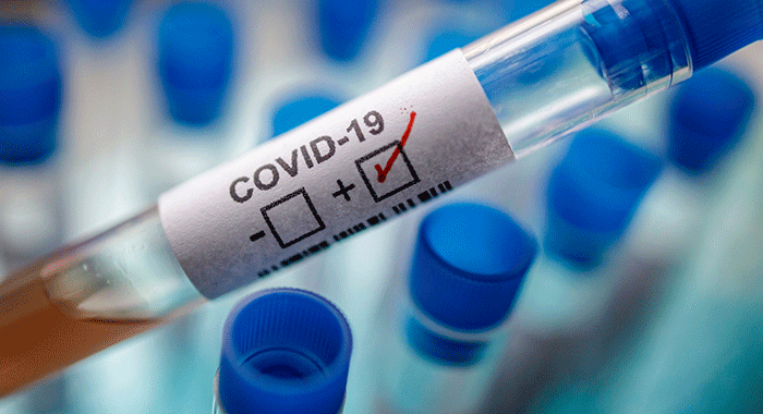 COvid-19-positive-1