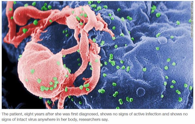 HIV-woman-cured
