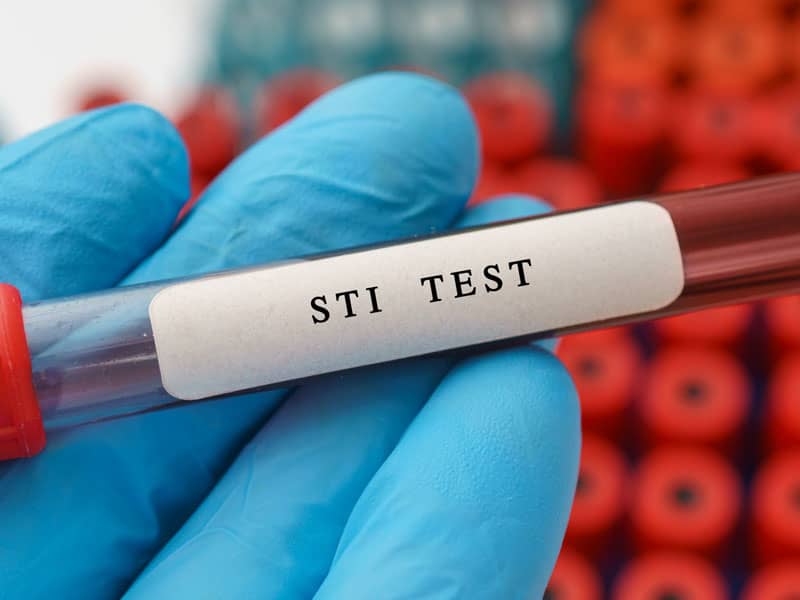 sti