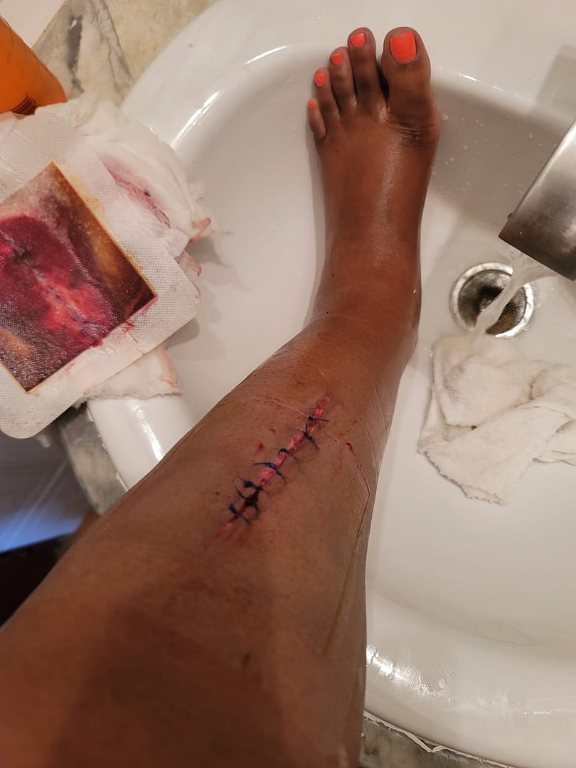 leg
