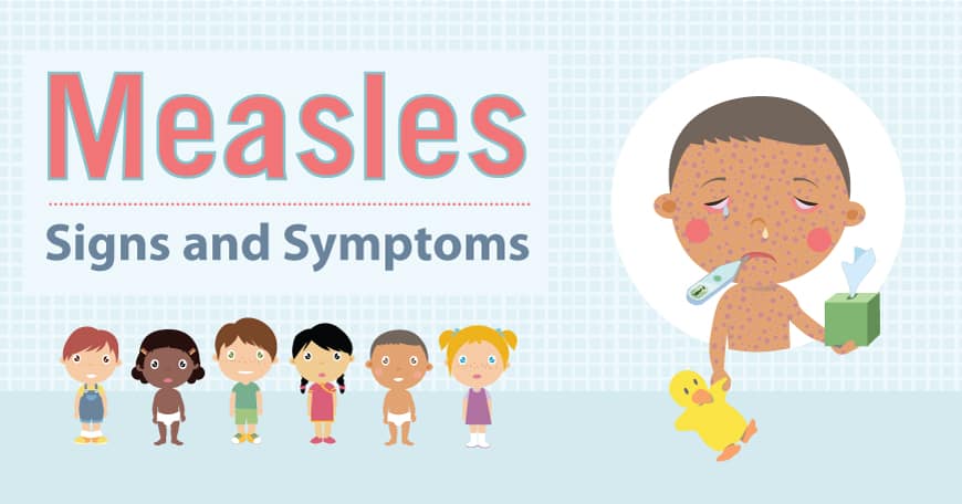 flex-childhood-measles