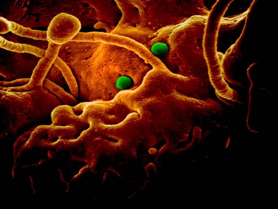 coronavirus111